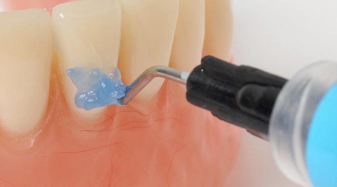 Ventura Etching Gel | MADESPA