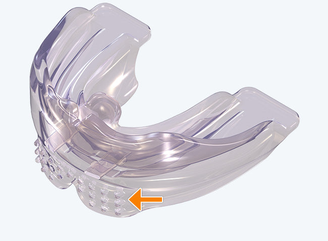 MyoBrace A1 for Adults | Ages 15 and up | Myofunctional appliance to correct oral habits and align teeth