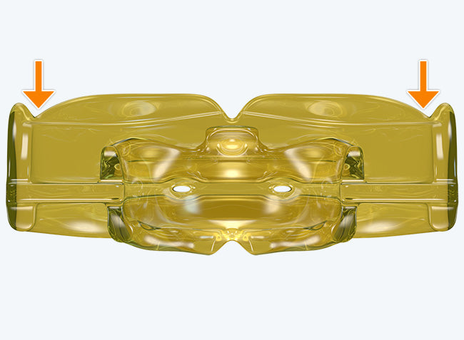 I3N Myobrace| Ages 5-12 | Orthodontic Appliance