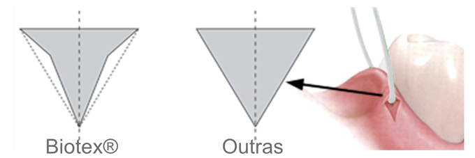 Biotex | Sutura de PTFE de Alta Performance | PURGO