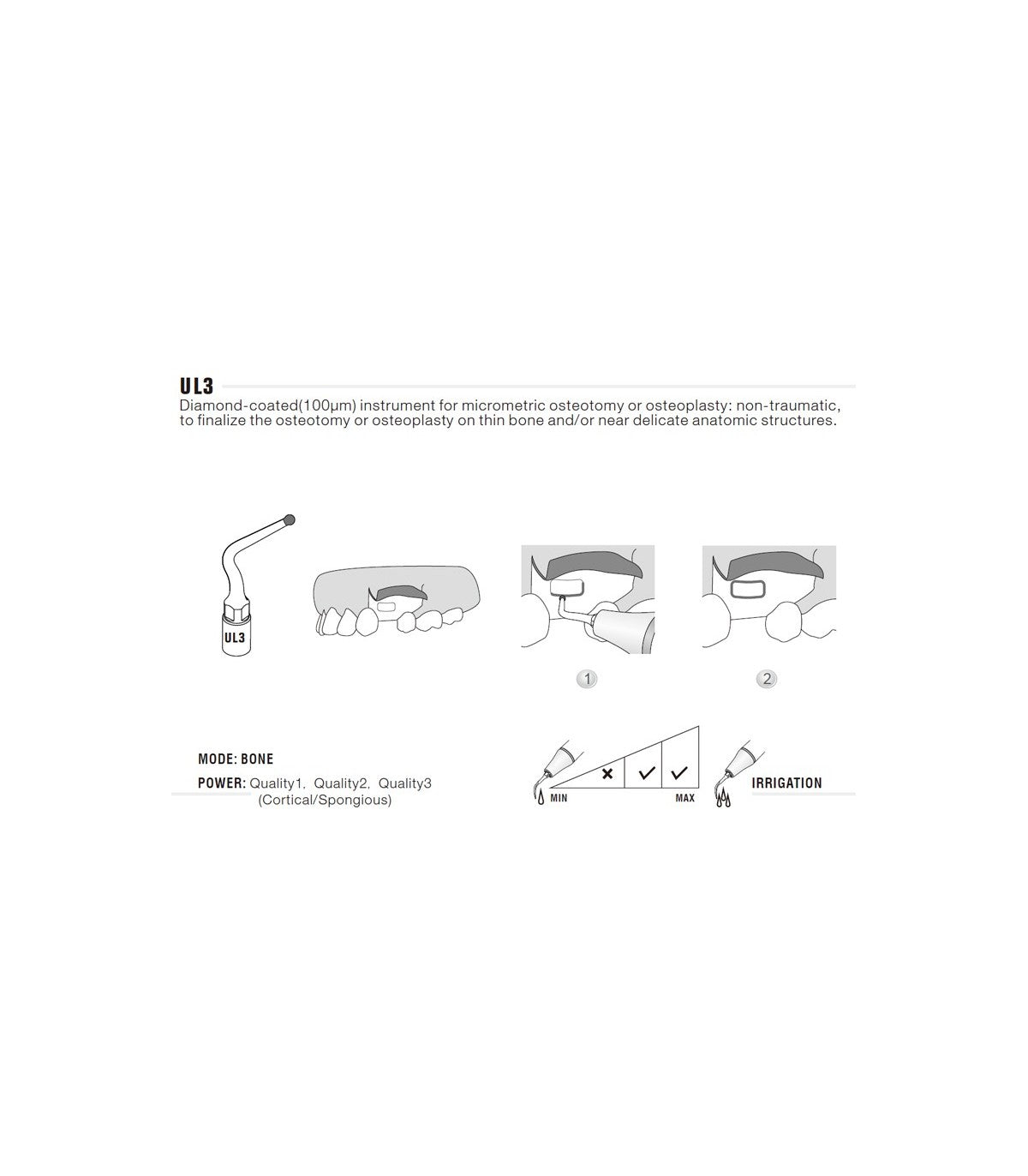 Ponta de Cirurgia para Osteoplastia | WOODPECKER