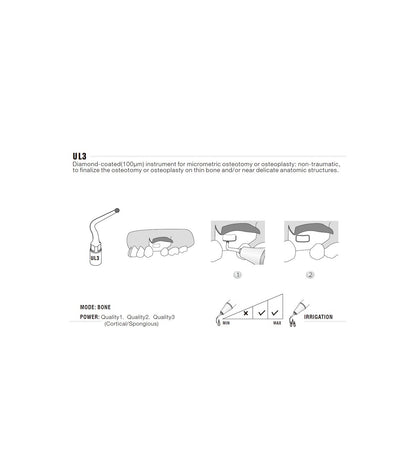 Ponta de Cirurgia para Osteoplastia | WOODPECKER