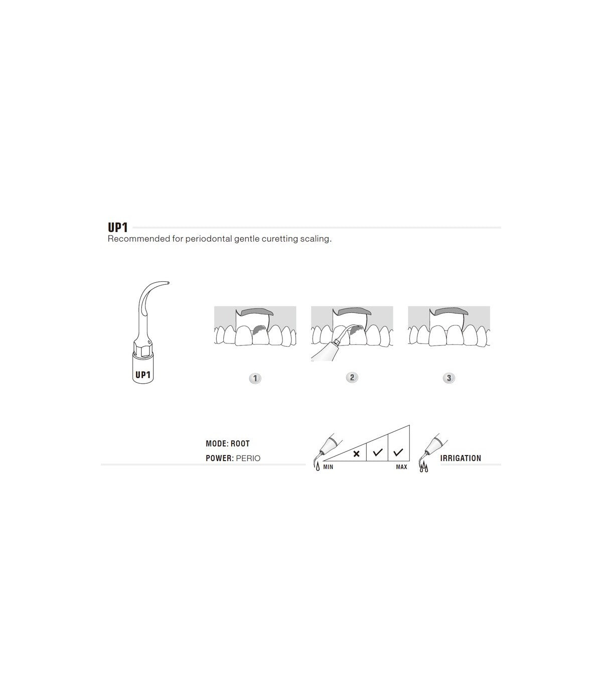 Ponta de Cirurgia UP1  Perio | WOODPECKER
