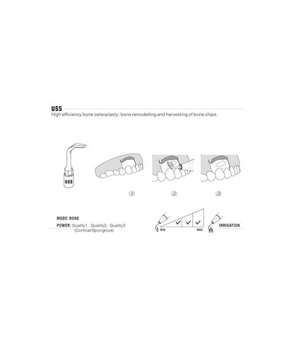 Ponta de Cirurgia para Osteoplastia | WOODPECKER